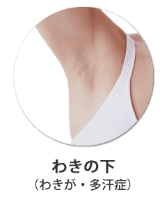 わきが（腋臭症）